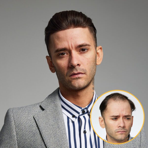 A man with a gray suit and striped shirt is looking at the camera.